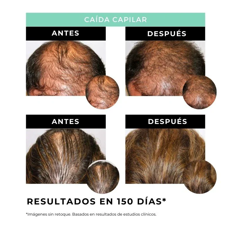 Strength - Sérum Fortalecedor del Cabello - Image 3