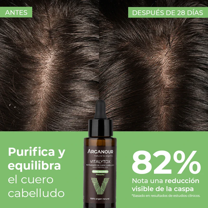 Vitalytox - Revitalizante de cuero cabelludo - Image 5